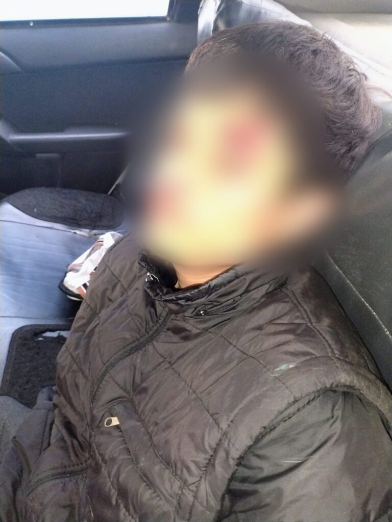Rápida acción policial permitió la aprehensión individuo tras atentar contra servidores policiales