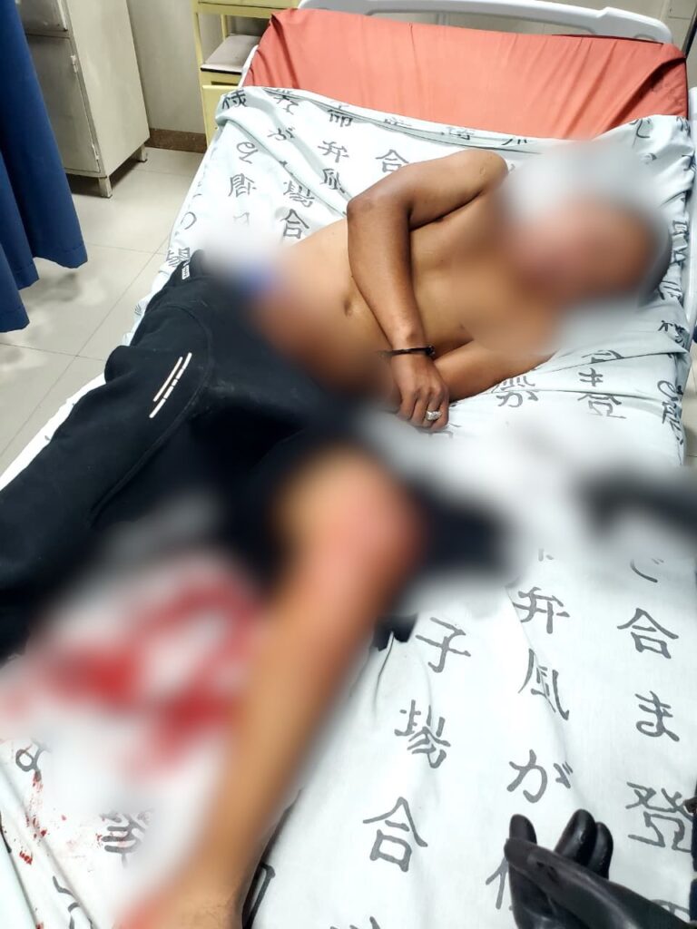 Neutralizamos a un sujeto que atentó contra la vida de un servidor policial en Pichincha